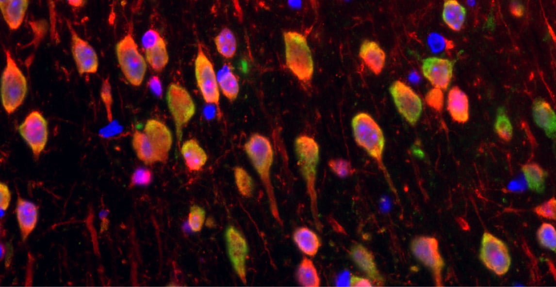  Khvorova research-card.jpg