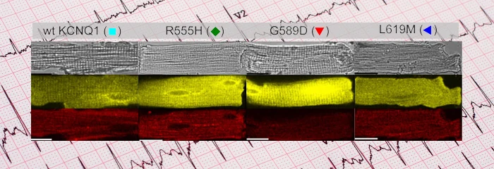 Cardiac Potassium Channels