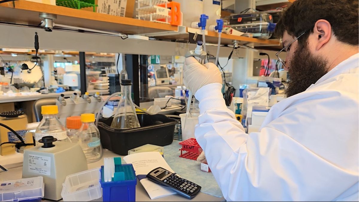 Cytokine-Stressed Human Pancreatic Islets