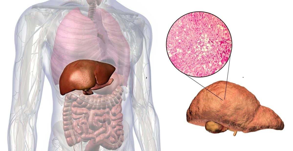 Liver Research at UMass Chan Medical School