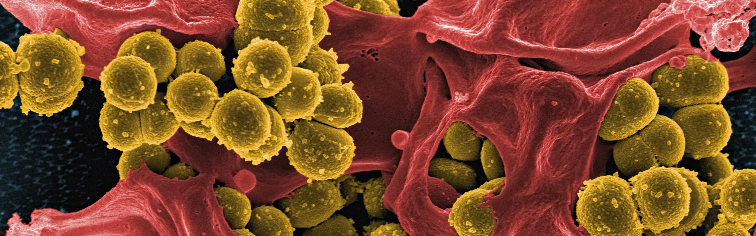 Methycillin resistant staph aureus bacteria (gold) with a neutrophil (red). Image credit: NIAID.