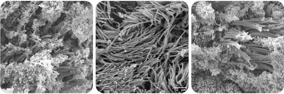 Dr. Chris Mueller from the Mueller Lab (Horae Gene Therapy Center) is conducting research and developing therapeutic strategies for rare inherited diseases such as the Cystic Fibrosis Dr. Chris Mueller from the Mueller Lab (Horae Gene Therapy Center) is conducting research and developing therapeutic strategies for rare inherited diseases such as the Cystic Fibrosis