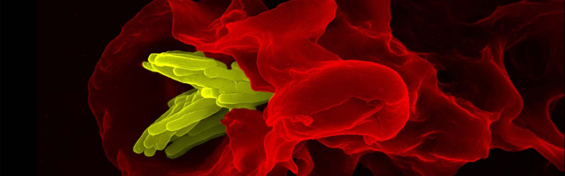 Infectious Diseases and Immunology