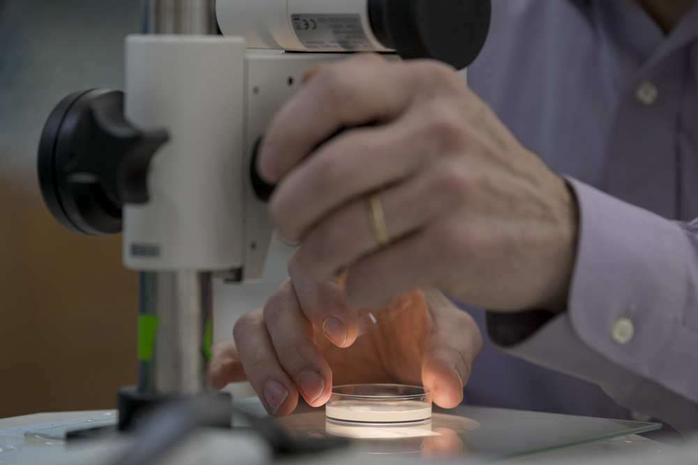 Close-up photo of Victor Ambros' hand holding an experimental gel under a microscope 