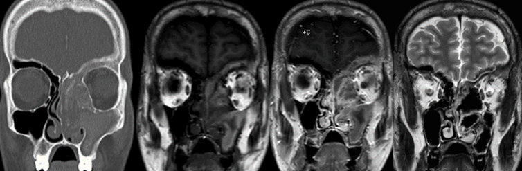 Images of x-rays of skulls