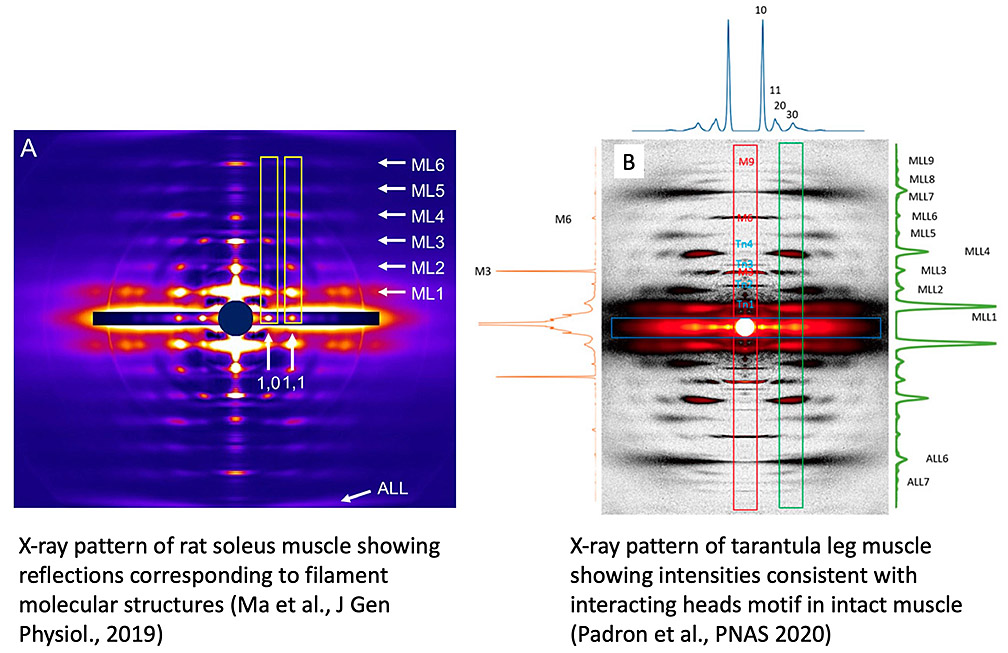 Padr&oacute;n-Craig Lab - UMass Chan - Xray patterns of muscle