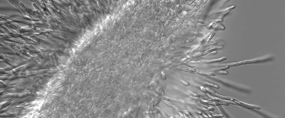 Microbial pathogenesis