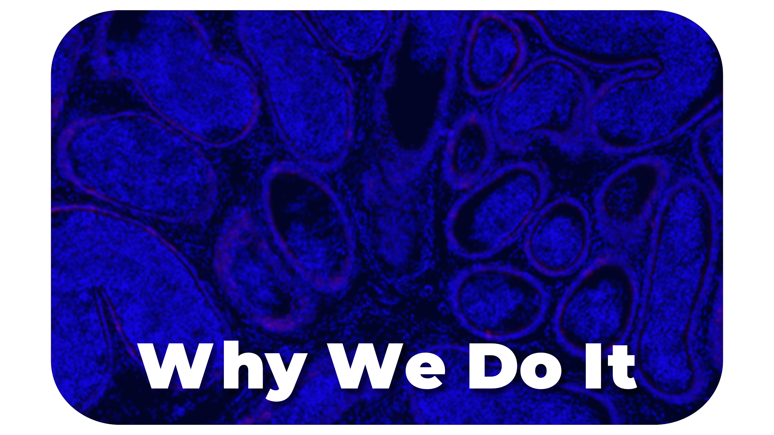  why we do it_rando.png