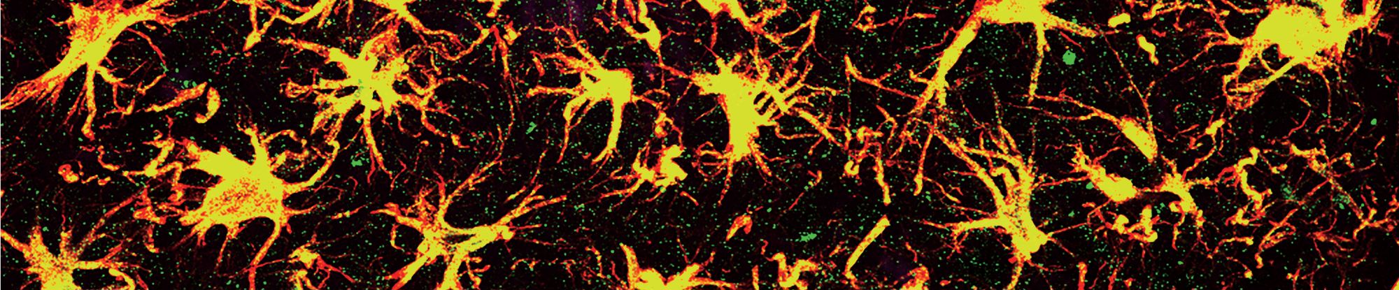 resesarch slider_zXu DRAFT.png