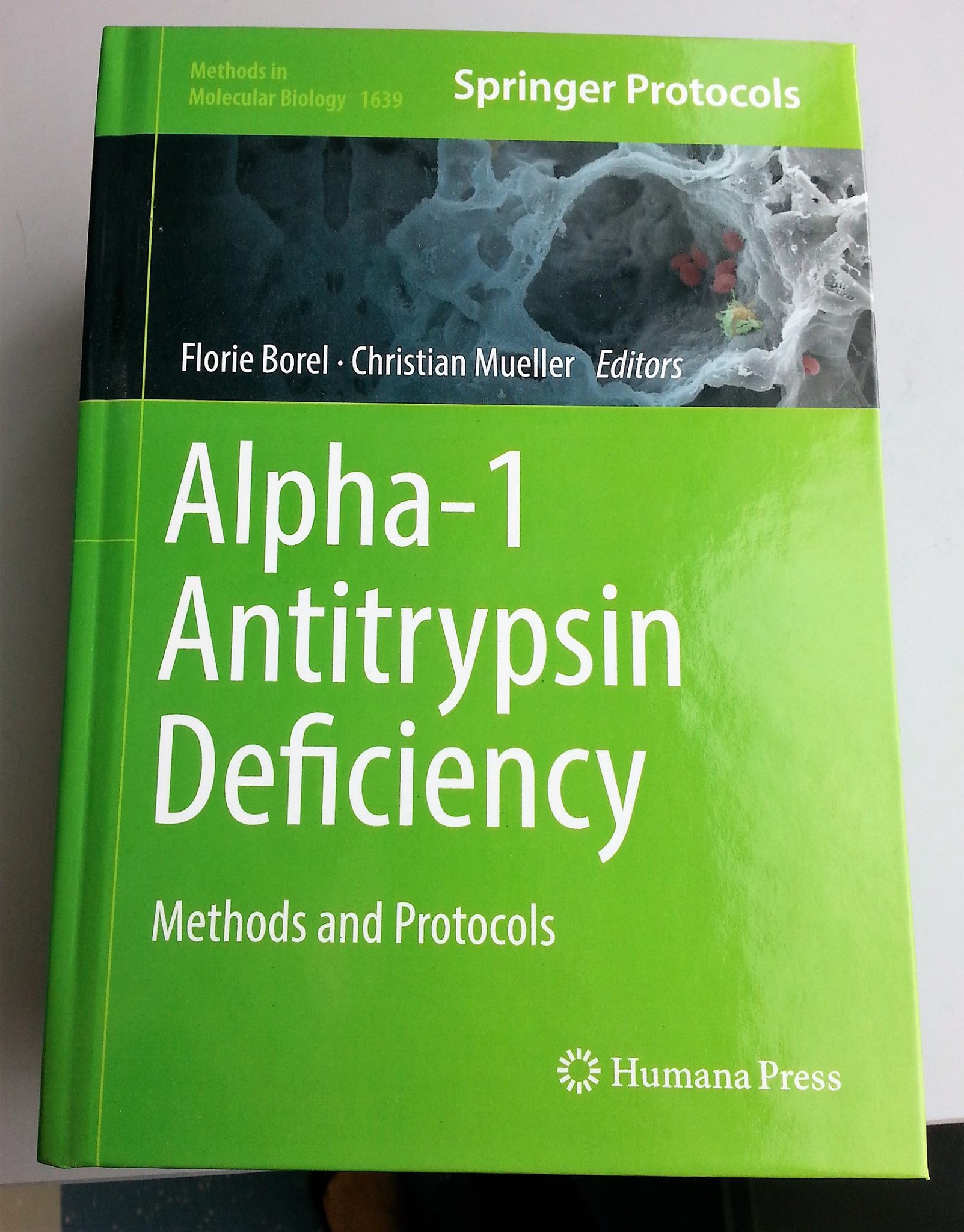 Alpha-1 antitrypsin deficiency methods protocols Springer Nature Borel Mueller Alpha-1 antitrypsin deficiency methods protocols Springer Nature Borel Mueller